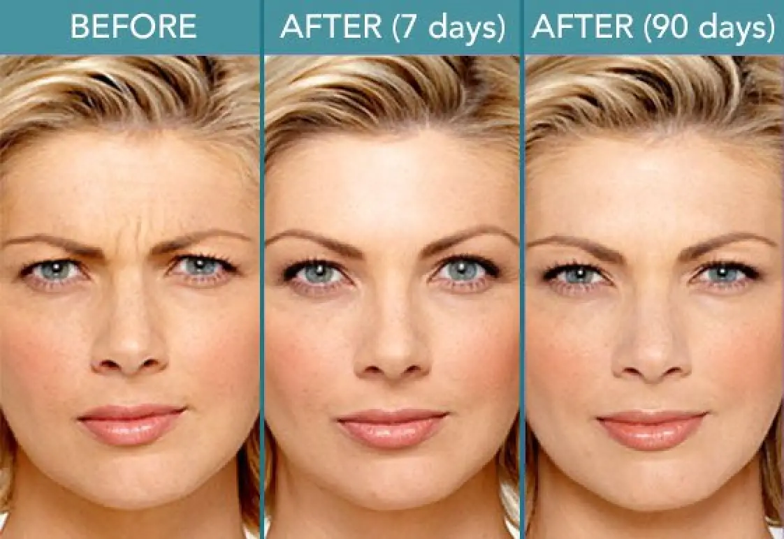 Before & After