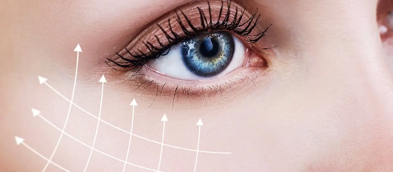 Eyelid Surgery Example