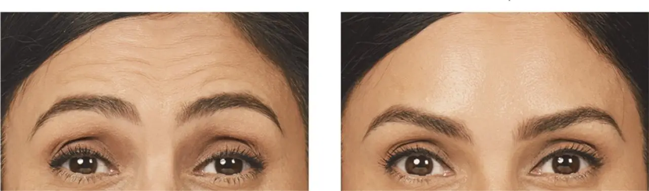Before & After