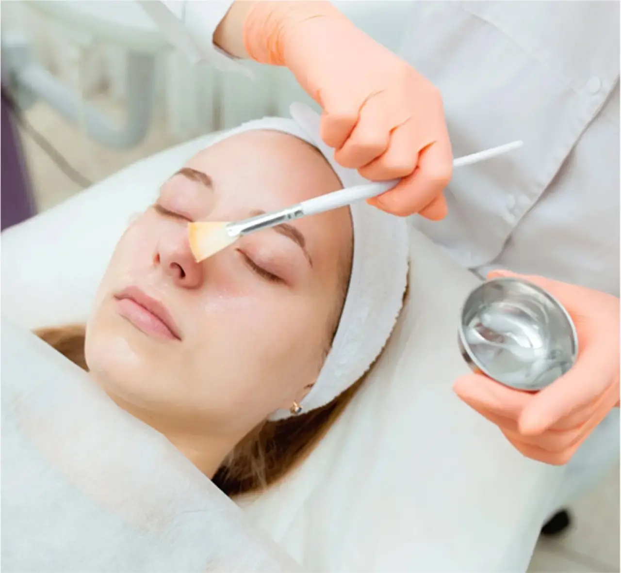 Chemical Peels