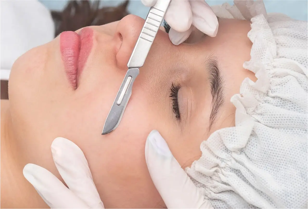 Dermaplaning