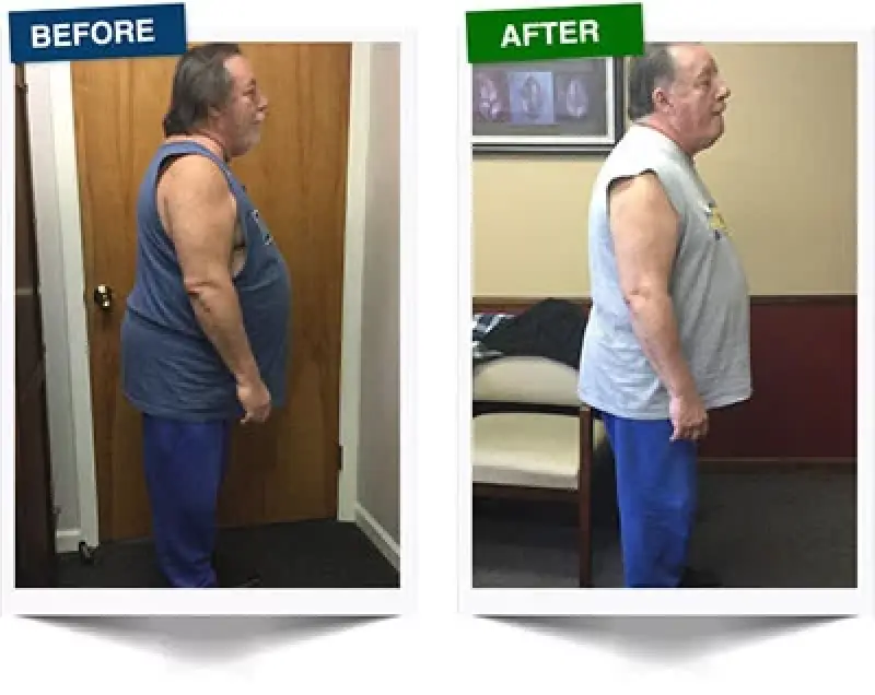 before and after weight loss side profile of a man in a room