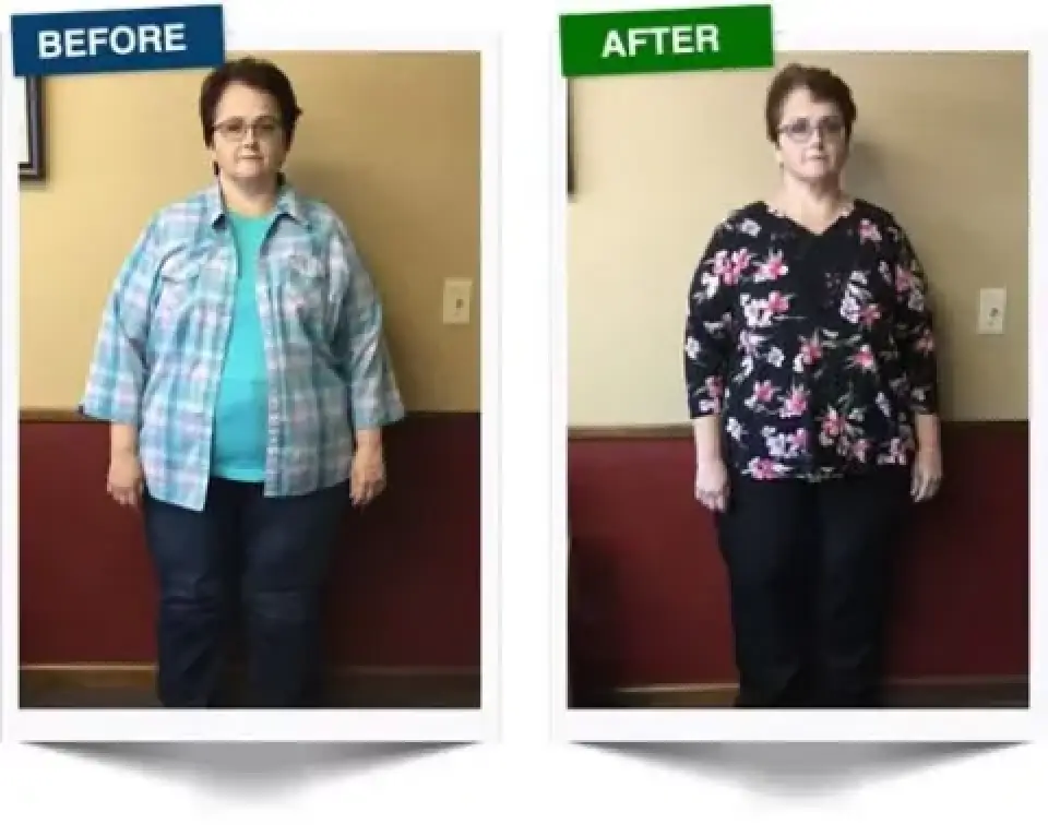womans weight loss transformation: before and after photos, wearing different outfits