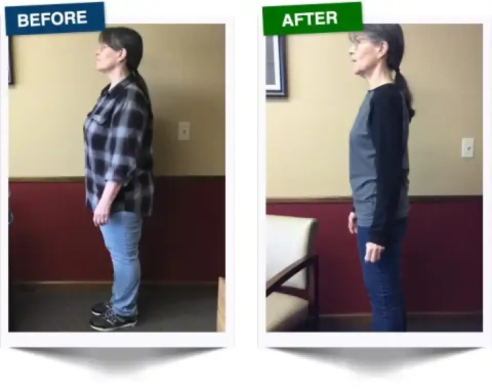 side by side comparison of a woman before and after health improvement, standing in profile