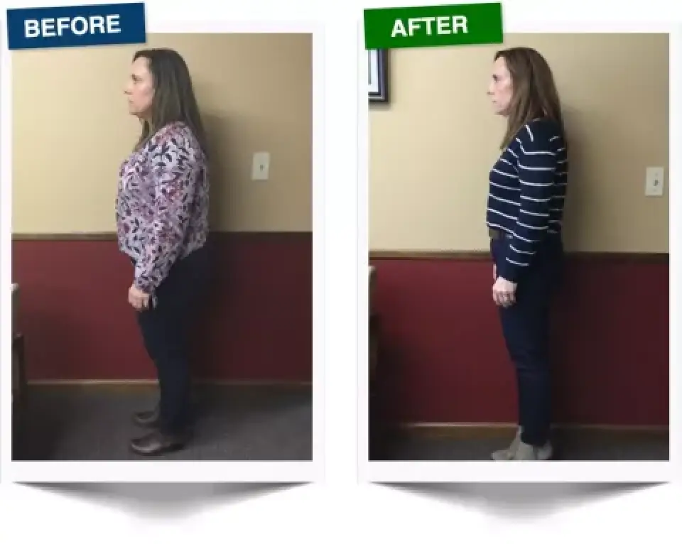 side by side comparison of a woman before and after weight loss