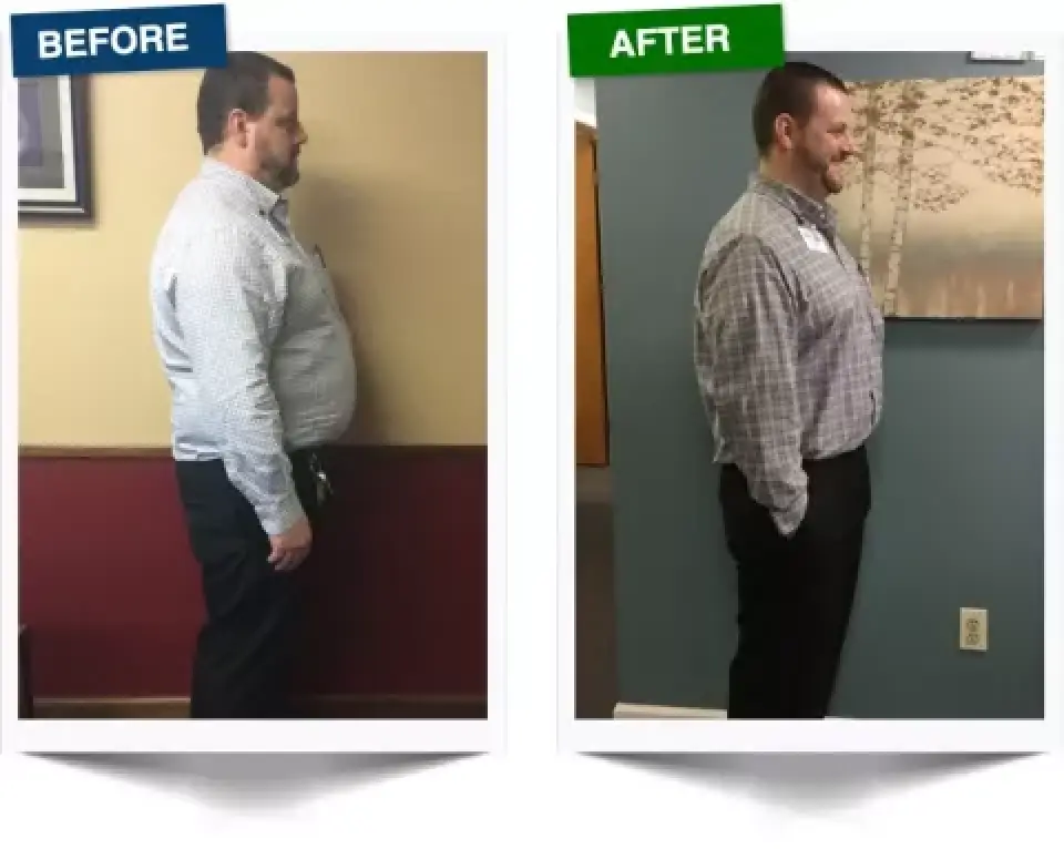 side by side comparison of a mans weight loss transformation: before and after pictures