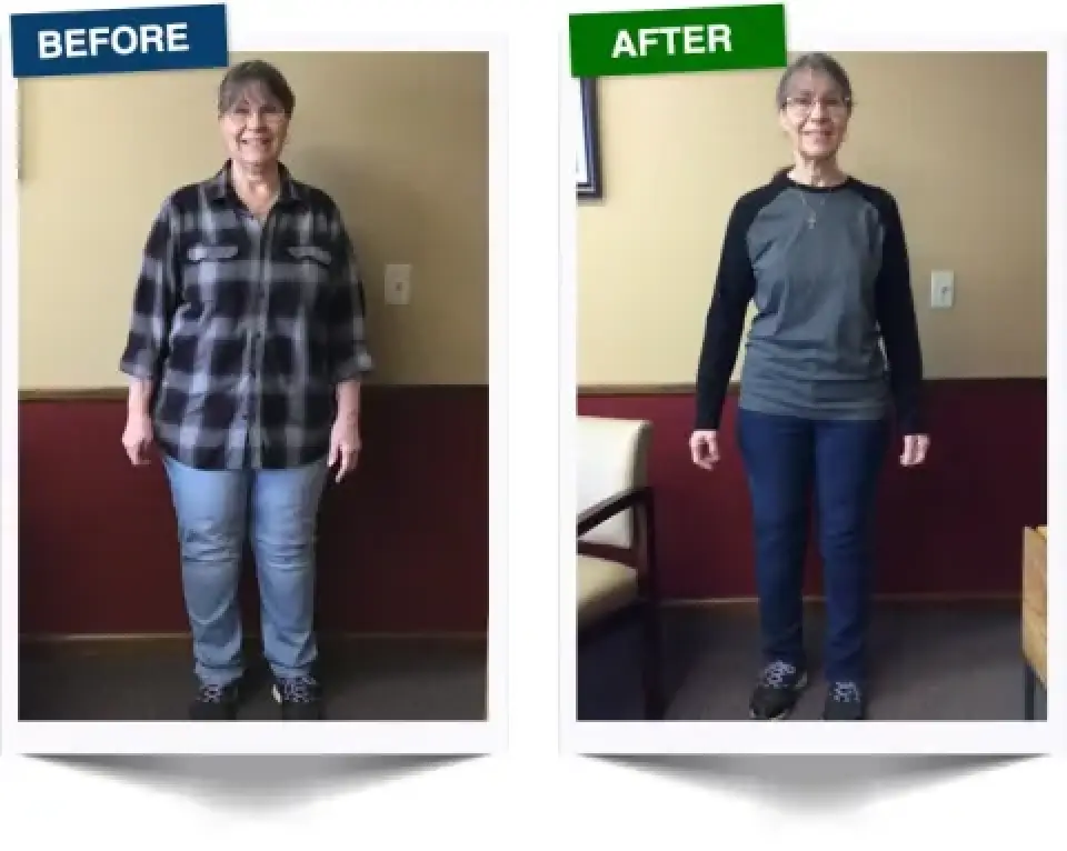 womans weight loss journey before and after photos, wearing different outfits
