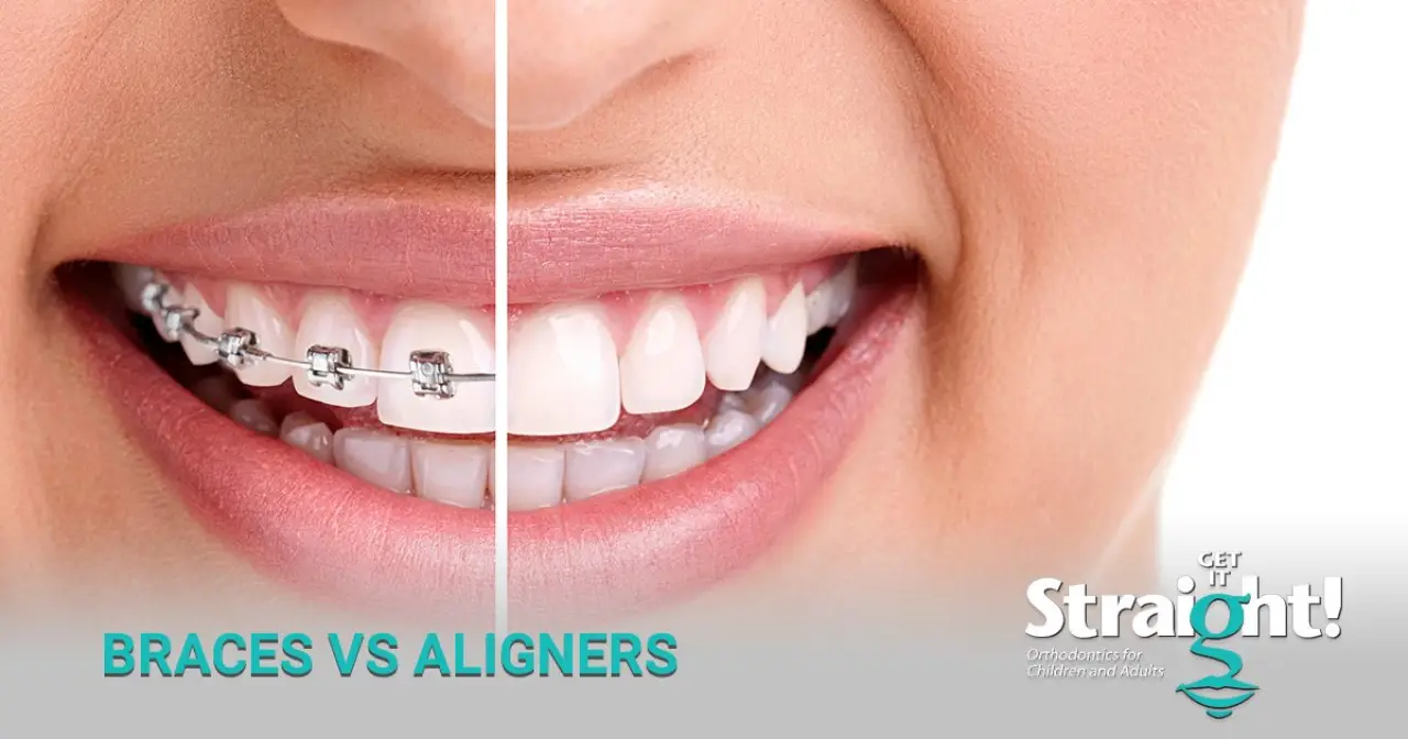 Making the Choice Between Metal Braces and Invisalign™