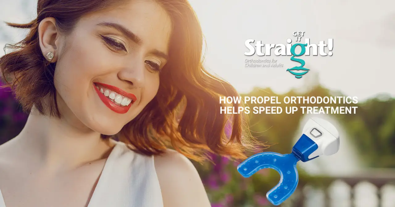 How Propel Orthodontics Helps Speed Up Treatment