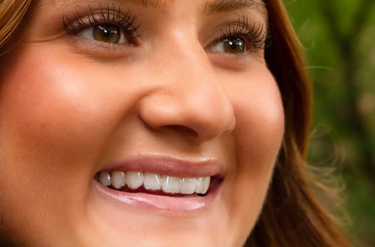 Woman smiling outdoors, showing white teeth and clear skin with green blurred background.