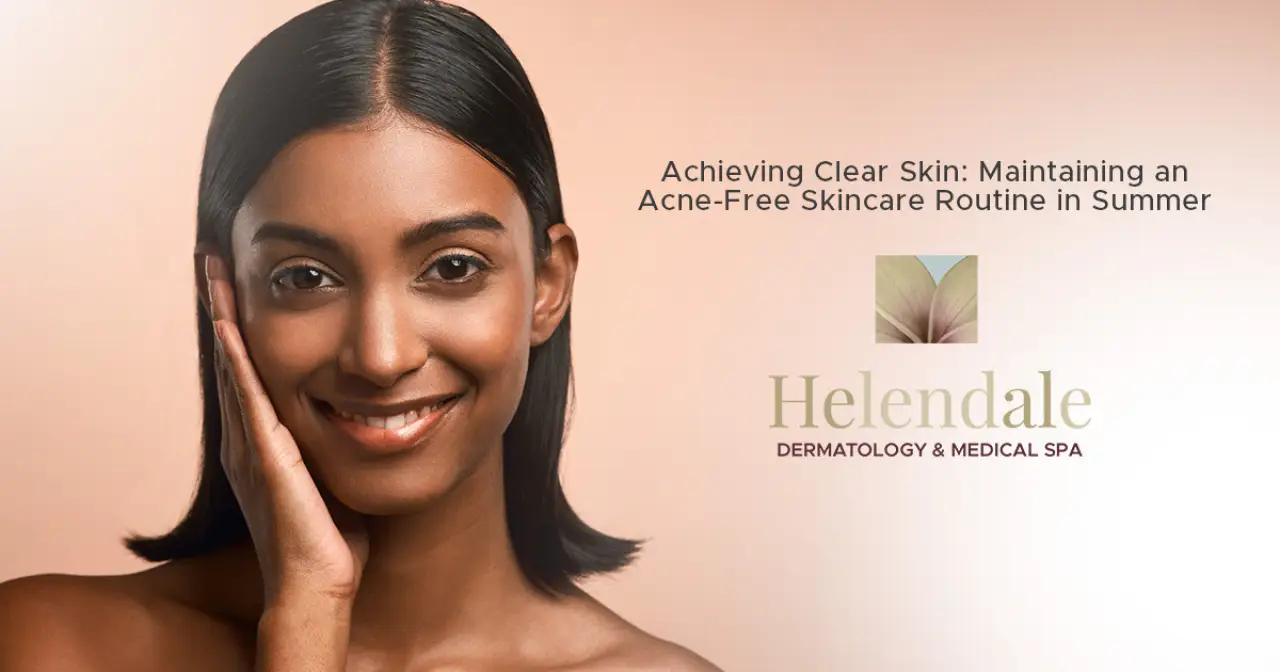 Achieving Clear Skin: Maintaining an Acne-Free Skincare Routine in Summer