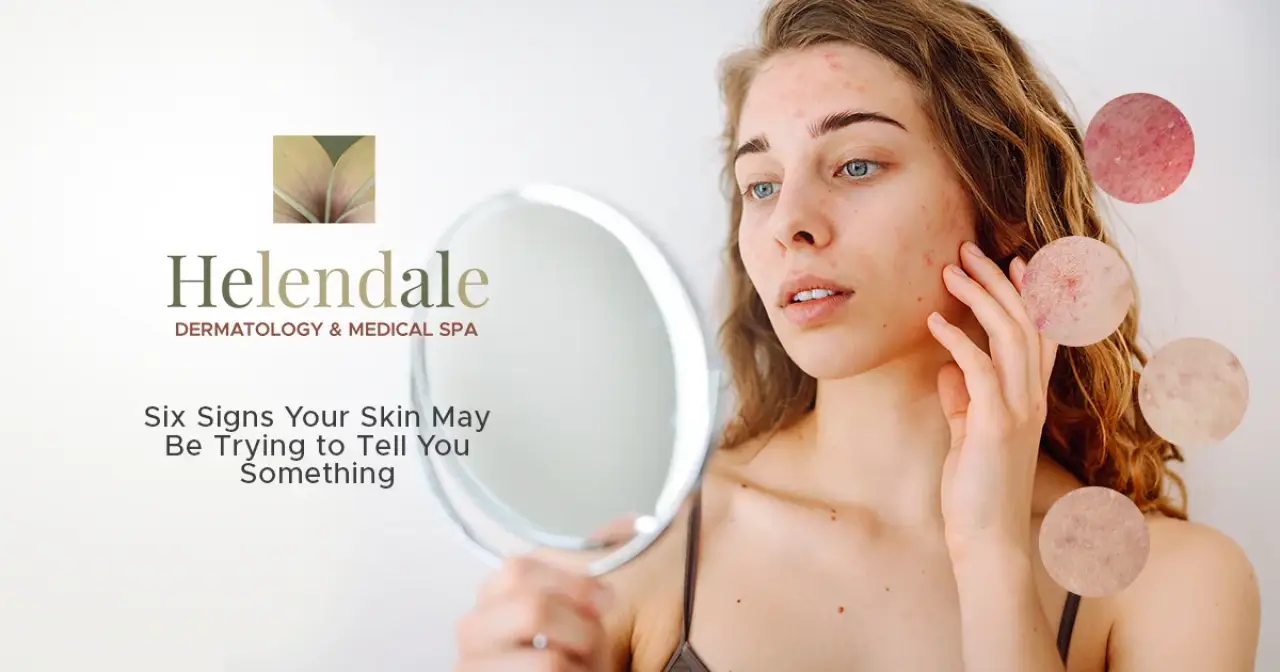 Six Signs Your Skin May Be Trying to Tell You Something