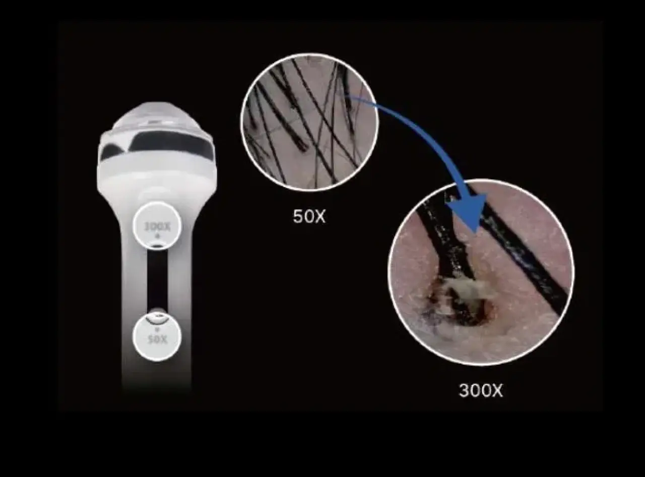 The Hair Restoration Opportunity