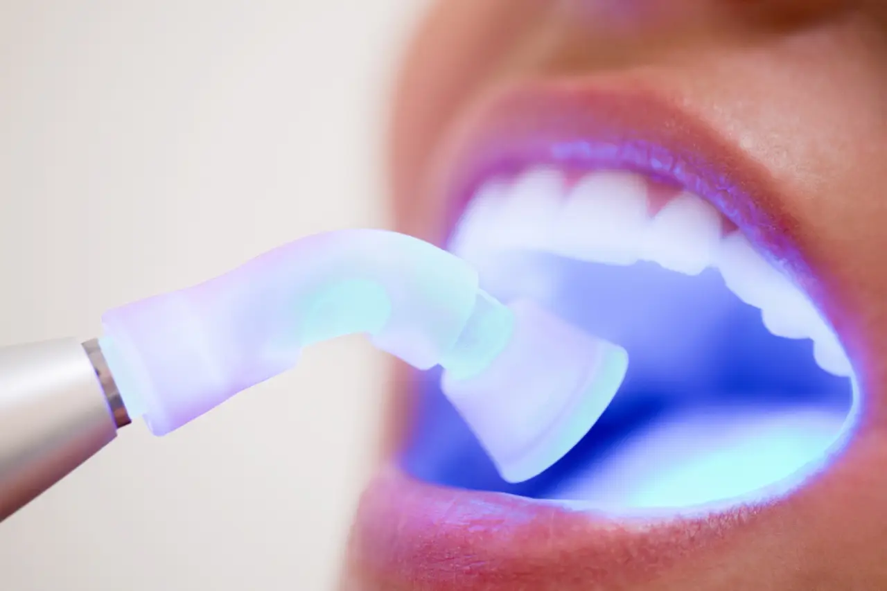 UV light for dental bonding