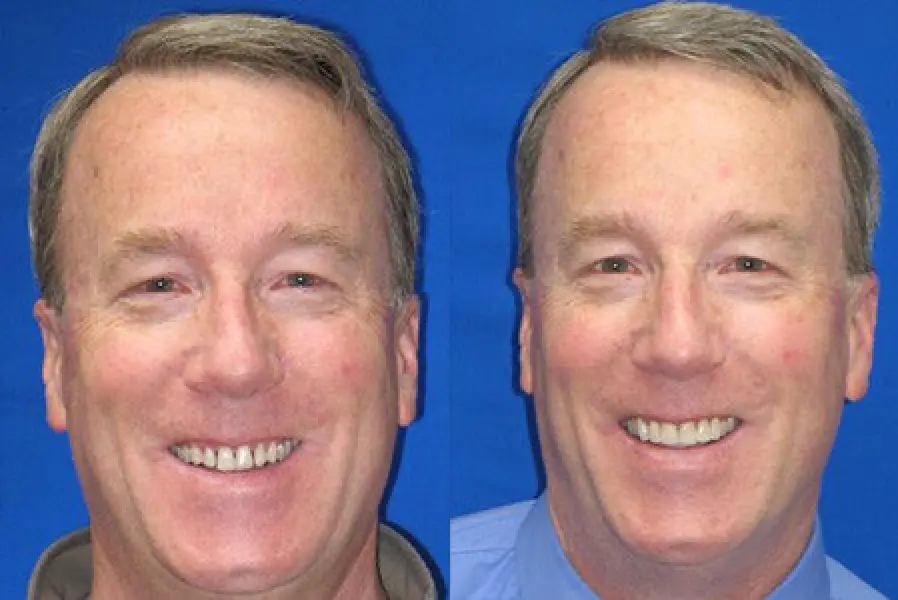 patient dave before & after