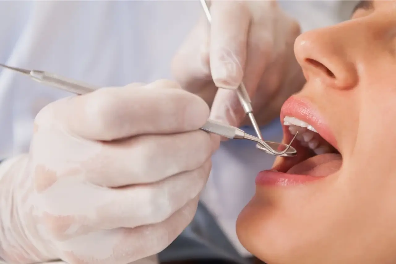 Dentist wearing gloves examining a patient's open mouth with dental tools.