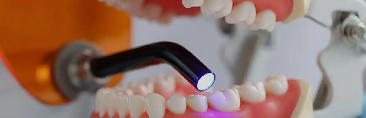dental fillings
