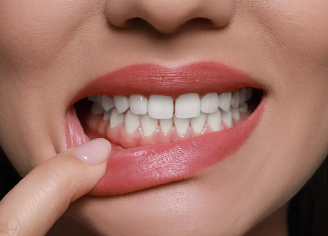 woman pulling down her lip to point at her gums