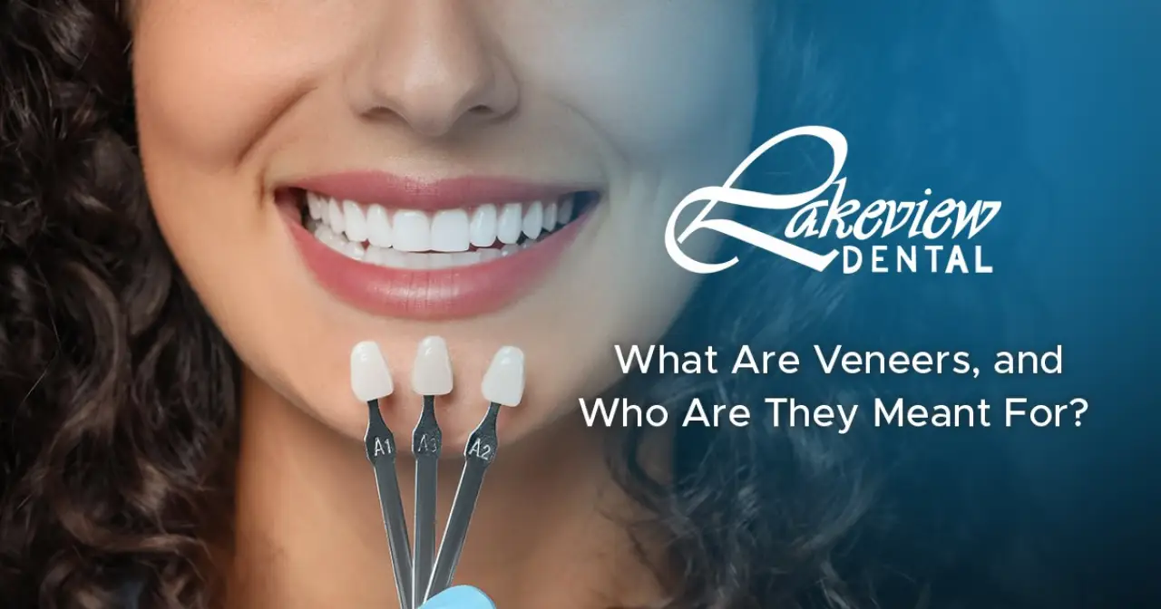 What Are Veneers, and Who Are They Meant For?