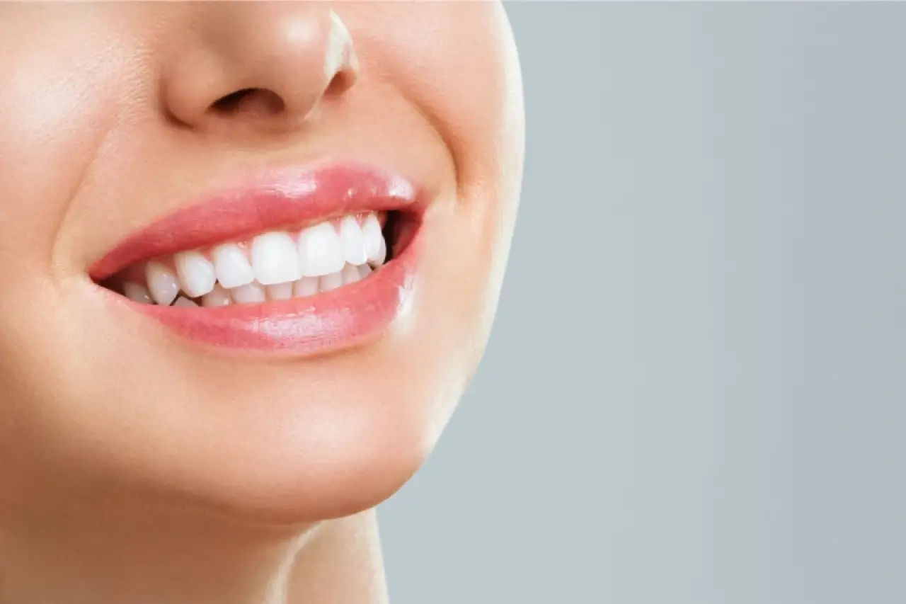 Close-up of a womans smile showing straight white teeth against a light gray background.