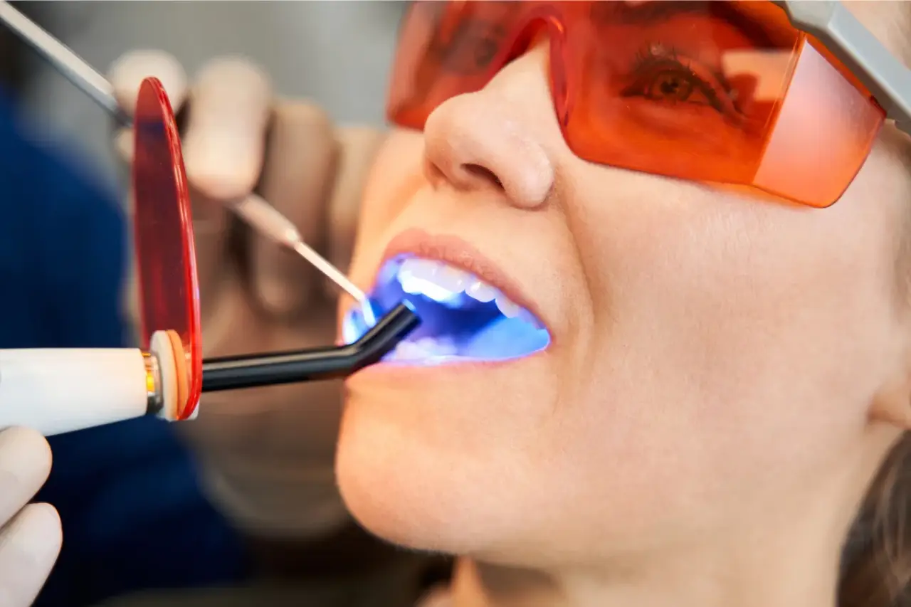 Person with orange glasses undergoing dental procedure with curing light in an open mouth.