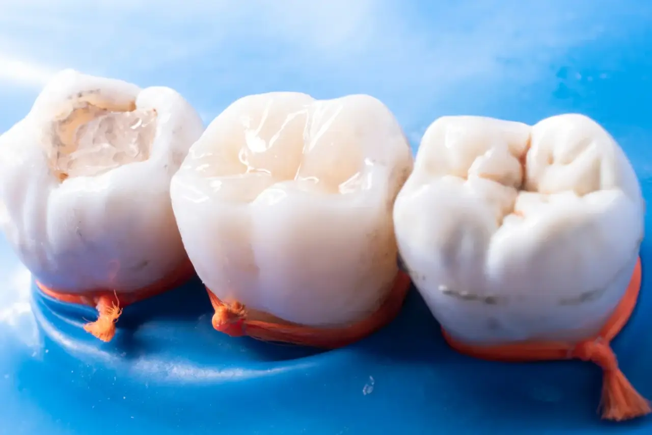 Close-up of three molars on a blue surface, tied with orange floss.