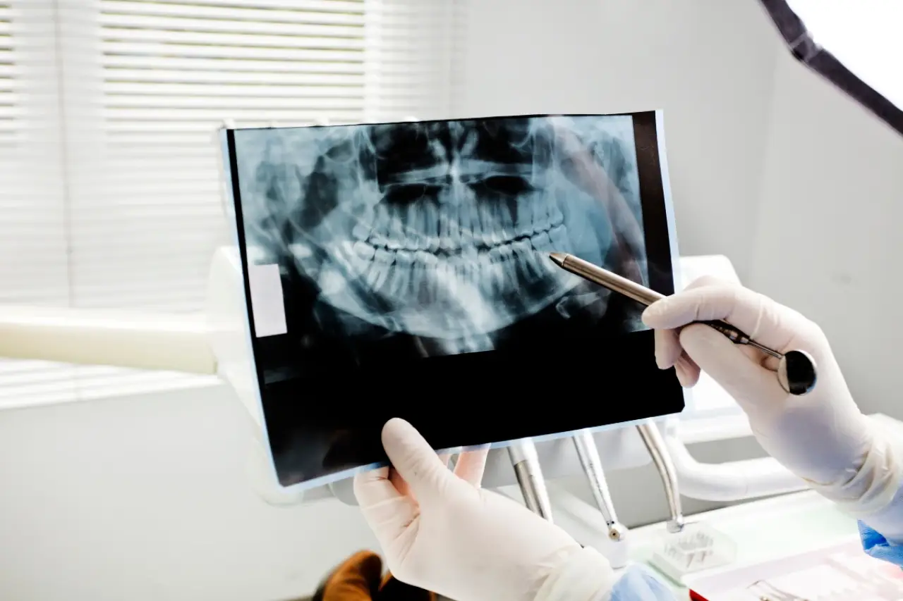Gloved hands hold and point to a dental X-ray image in a bright dental office.
