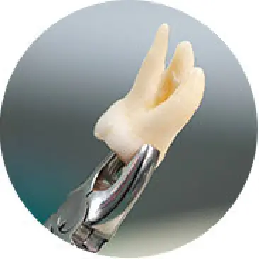 Extractions